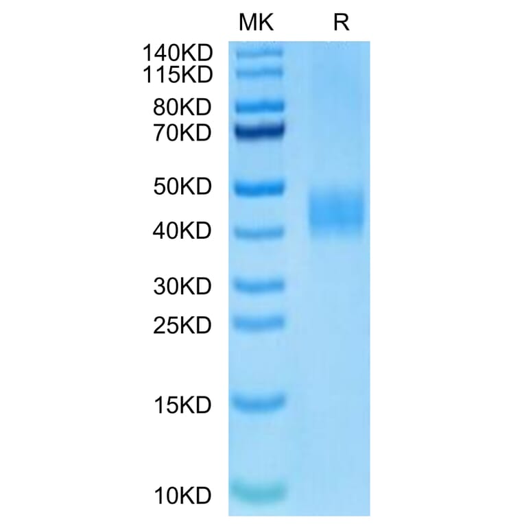 Tris-Bis PAGE - Recombinant Human B7-H3 Protein (Biotin) (C-terminal His and Avi Tag) (A330137) - Antibodies.com