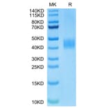 Tris-Bis PAGE - Recombinant Human B7-H3 Protein (Biotin) (C-terminal His and Avi Tag) (A330137) - Antibodies.com