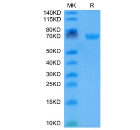 Tris-Bis PAGE - Recombinant Human B7-H3 Protein (C-terminal Human Fc Tag) (A330138) - Antibodies.com