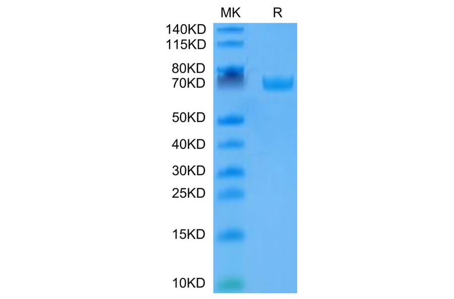 Tris-Bis PAGE - Recombinant Human B7-H3 Protein (C-terminal Human Fc Tag) (A330138) - Antibodies.com