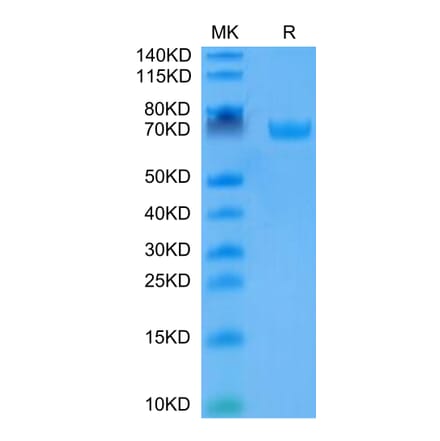 Tris-Bis PAGE - Recombinant Human B7-H3 Protein (C-terminal Human Fc Tag) (A330138) - Antibodies.com