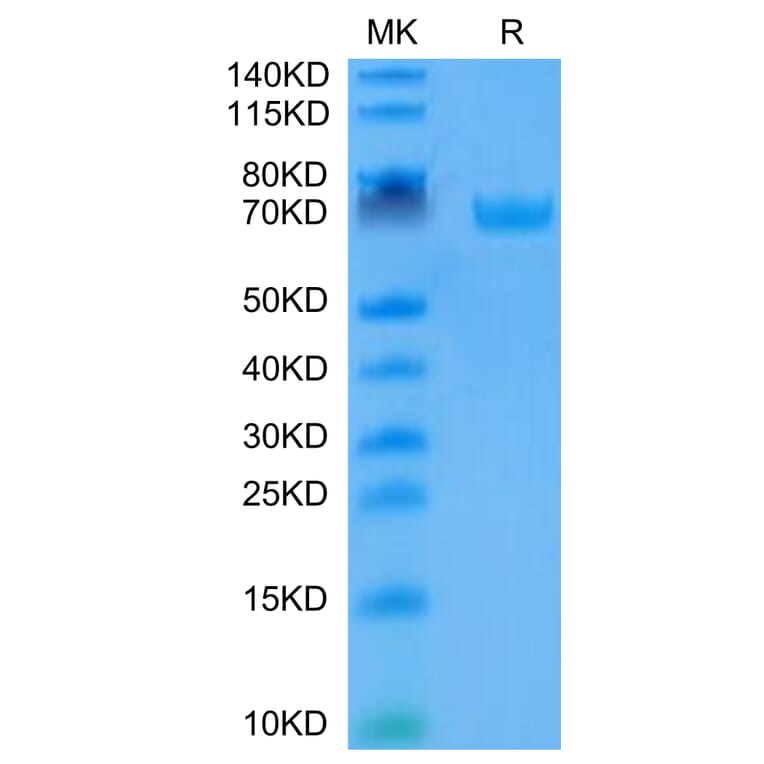 Tris-Bis PAGE - Recombinant Human B7-H3 Protein (C-terminal Human Fc Tag) (A330138) - Antibodies.com