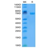 Tris-Bis PAGE - Recombinant Human B7-H3 Protein (C-terminal Human Fc Tag) (A330138) - Antibodies.com