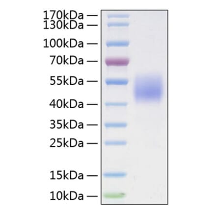 SDS-PAGE - Recombinant Human B7-H4 Protein (C-terminal His Tag) (A330139) - Antibodies.com