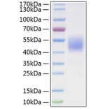 SDS-PAGE - Recombinant Human B7-H4 Protein (C-terminal His Tag) (A330139) - Antibodies.com