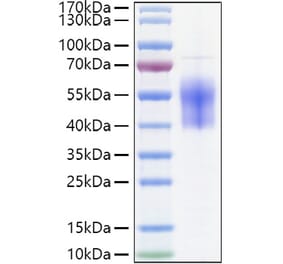 SDS-PAGE - Recombinant Human B7-H6 Protein (C-terminal His Tag) (A330140) - Antibodies.com