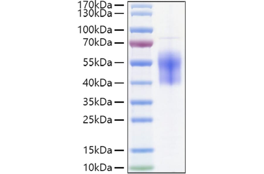SDS-PAGE - Recombinant Human B7-H6 Protein (C-terminal His Tag) (A330140) - Antibodies.com