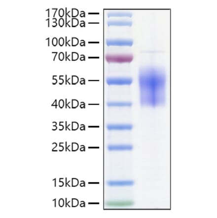SDS-PAGE - Recombinant Human B7-H6 Protein (C-terminal His Tag) (A330140) - Antibodies.com