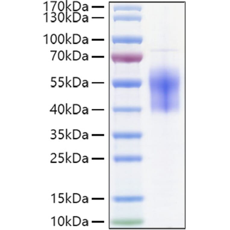 SDS-PAGE - Recombinant Human B7-H6 Protein (C-terminal His Tag) (A330140) - Antibodies.com