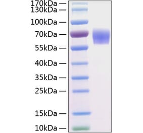 SDS-PAGE - Recombinant Human BACE1 Protein (C-terminal His Tag) (A330141) - Antibodies.com