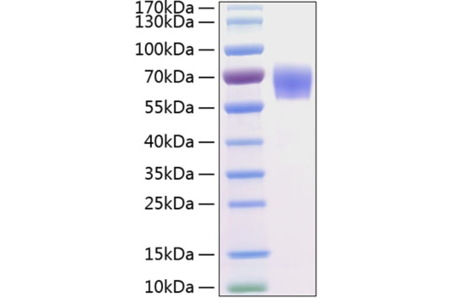 SDS-PAGE - Recombinant Human BACE1 Protein (C-terminal His Tag) (A330141) - Antibodies.com