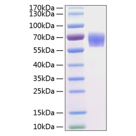 SDS-PAGE - Recombinant Human BACE1 Protein (C-terminal His Tag) (A330141) - Antibodies.com