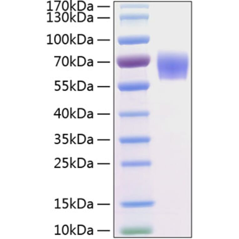 SDS-PAGE - Recombinant Human BACE1 Protein (C-terminal His Tag) (A330141) - Antibodies.com