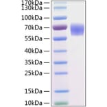 SDS-PAGE - Recombinant Human BACE1 Protein (C-terminal His Tag) (A330141) - Antibodies.com