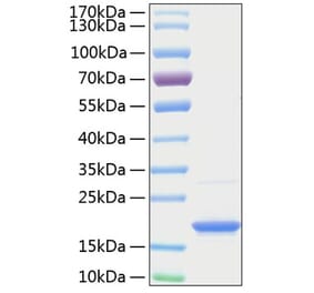 SDS-PAGE - Recombinant Human BAFF Protein (A330142) - Antibodies.com