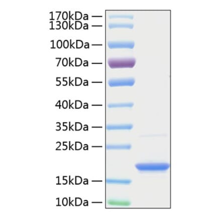 SDS-PAGE - Recombinant Human BAFF Protein (A330142) - Antibodies.com