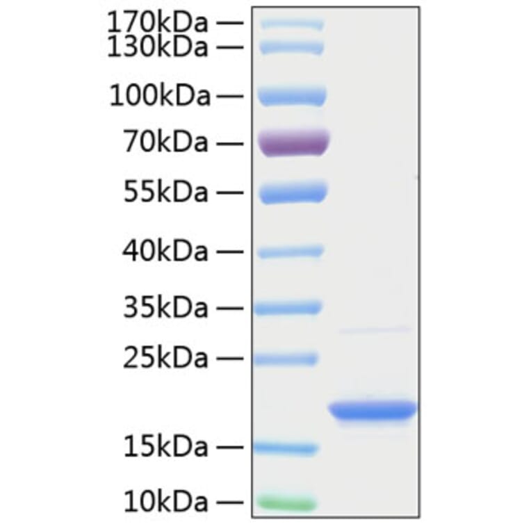 SDS-PAGE - Recombinant Human BAFF Protein (A330142) - Antibodies.com