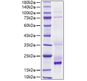 SDS-PAGE - Recombinant human BAFF Protein (N-terminal His Tag) (A330143) - Antibodies.com