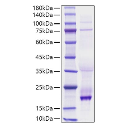 SDS-PAGE - Recombinant human BAFF Protein (N-terminal His Tag) (A330143) - Antibodies.com