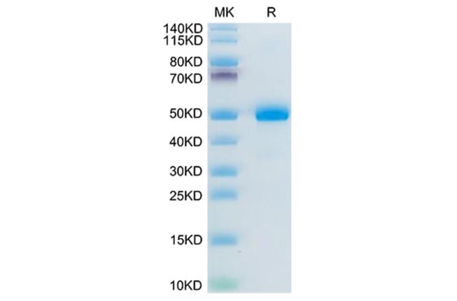 Tris-Bis PAGE - Recombinant Mouse BAMBI Protein (C-terminal Human Fc Tag) (A330144) - Antibodies.com