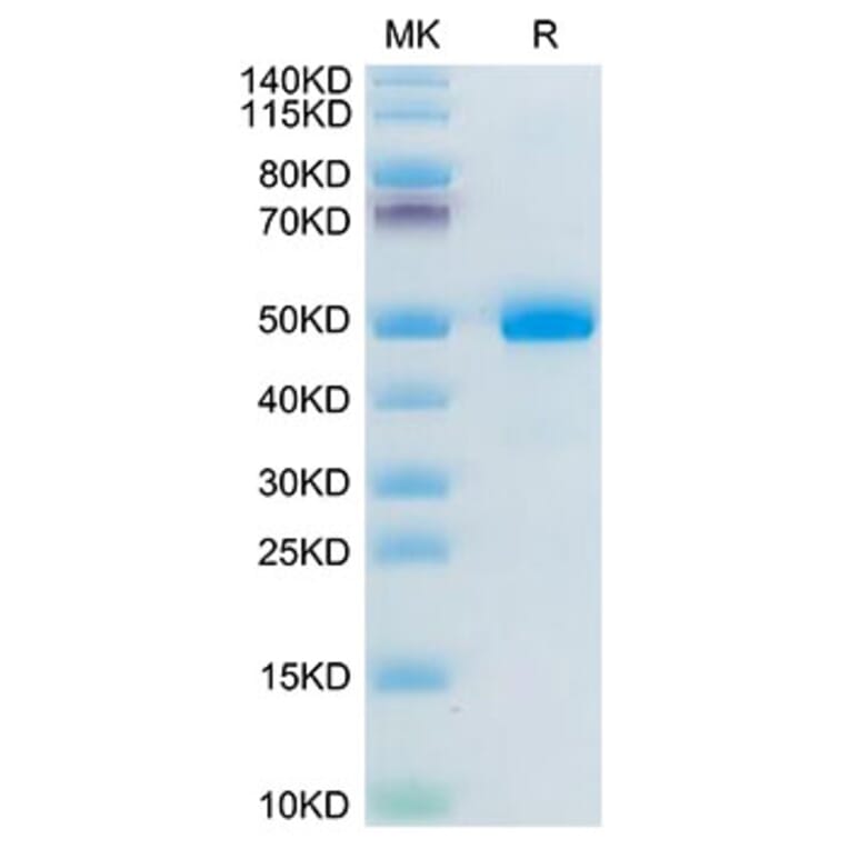 Tris-Bis PAGE - Recombinant Mouse BAMBI Protein (C-terminal Human Fc Tag) (A330144) - Antibodies.com