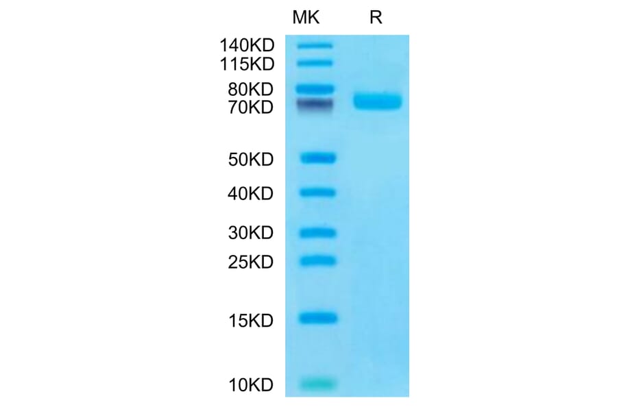 Tris-Bis PAGE - Recombinant Human BCAM Protein (C-terminal His Tag) (A330145) - Antibodies.com