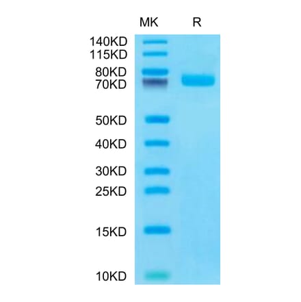 Tris-Bis PAGE - Recombinant Human BCAM Protein (C-terminal His Tag) (A330145) - Antibodies.com