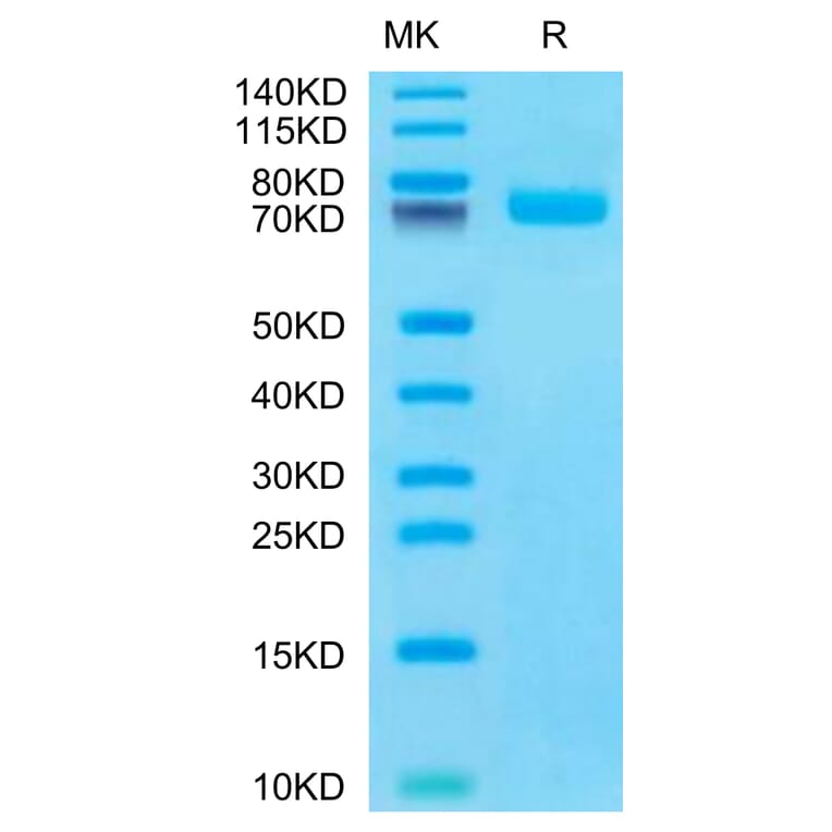 Tris-Bis PAGE - Recombinant Human BCAM Protein (C-terminal His Tag) (A330145) - Antibodies.com