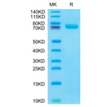 Tris-Bis PAGE - Recombinant Human BCAM Protein (C-terminal His Tag) (A330145) - Antibodies.com