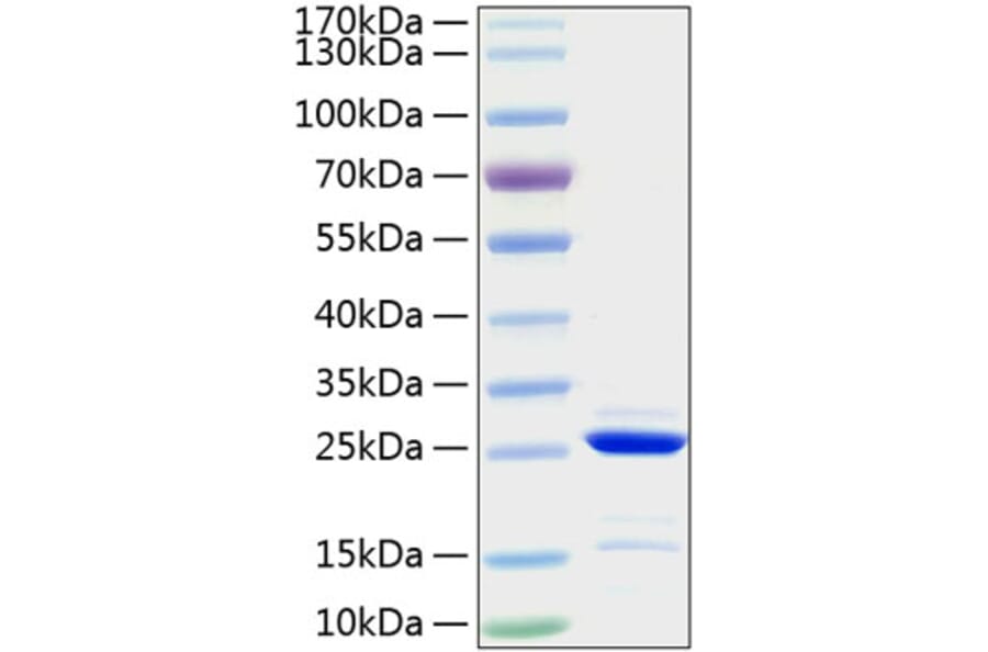 SDS-PAGE - Recombinant Human Bcl-2 Protein (A330146) - Antibodies.com