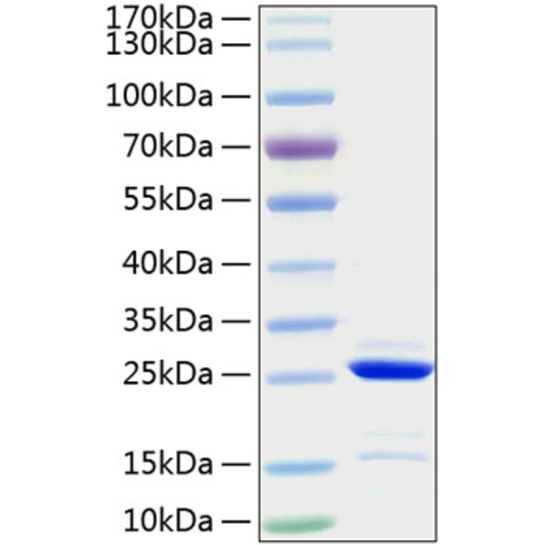 SDS-PAGE - Recombinant Human Bcl-2 Protein (A330146) - Antibodies.com