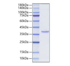 SDS-PAGE - Recombinant Rat BCMA Protein (N-terminal Human Fc Tag) (A330147) - Antibodies.com