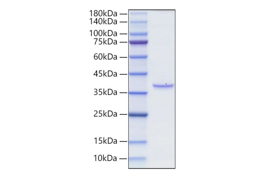 SDS-PAGE - Recombinant Rat BCMA Protein (N-terminal Human Fc Tag) (A330147) - Antibodies.com