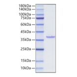 SDS-PAGE - Recombinant Rat BCMA Protein (N-terminal Human Fc Tag) (A330147) - Antibodies.com