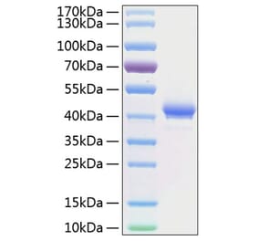 SDS-PAGE - Recombinant Human BCMA Protein (C-terminal Human Fc and His Tag) (A330148) - Antibodies.com