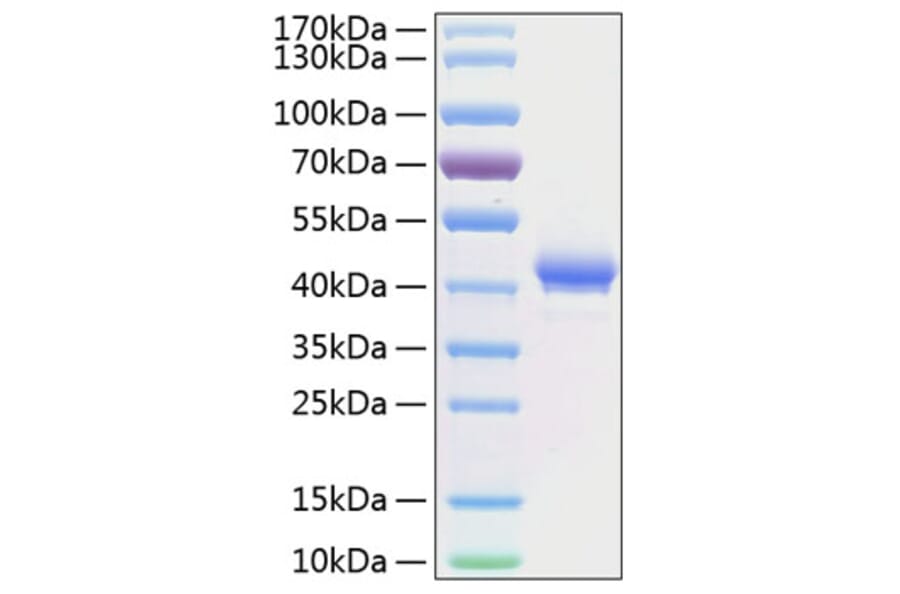 SDS-PAGE - Recombinant Human BCMA Protein (C-terminal Human Fc and His Tag) (A330148) - Antibodies.com