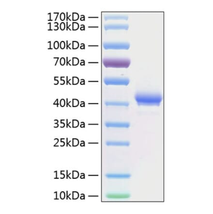 SDS-PAGE - Recombinant Human BCMA Protein (C-terminal Human Fc and His Tag) (A330148) - Antibodies.com