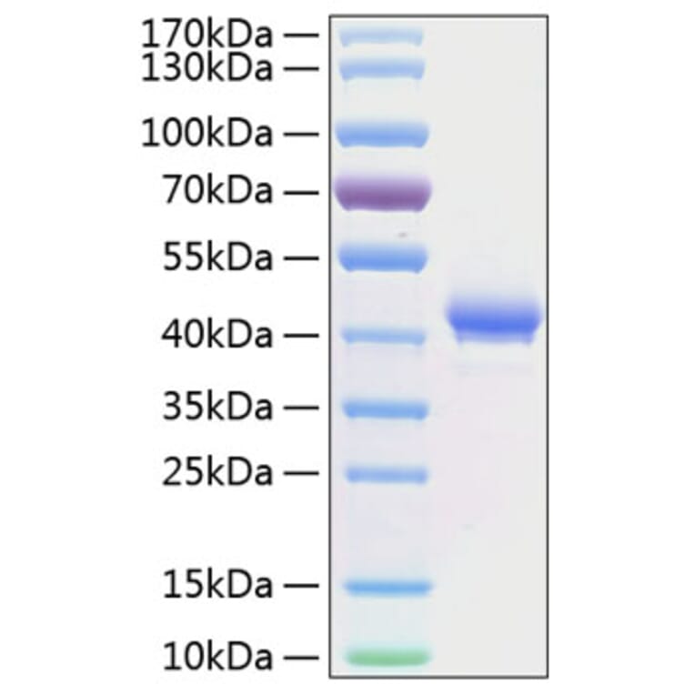 SDS-PAGE - Recombinant Human BCMA Protein (C-terminal Human Fc and His Tag) (A330148) - Antibodies.com