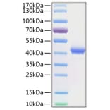 SDS-PAGE - Recombinant Human BCMA Protein (C-terminal Human Fc and His Tag) (A330148) - Antibodies.com