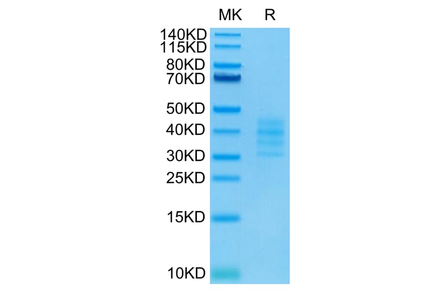 Tris-Bis PAGE - Recombinant Human BCMA Protein (Biotin) (C-terminal His and Avi Tag) (A330149) - Antibodies.com