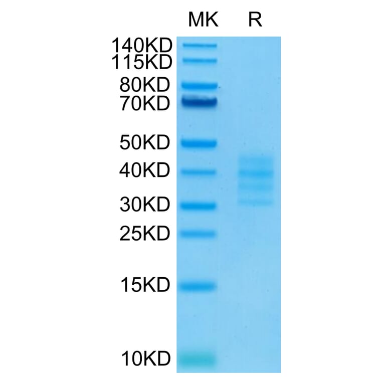 Tris-Bis PAGE - Recombinant Human BCMA Protein (Biotin) (C-terminal His and Avi Tag) (A330149) - Antibodies.com
