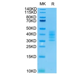 Tris-Bis PAGE - Recombinant Human BCMA Protein (C-terminal His and Avi Tag) (A330150) - Antibodies.com