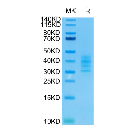 Tris-Bis PAGE - Recombinant Human BCMA Protein (C-terminal His and Avi Tag) (A330150) - Antibodies.com