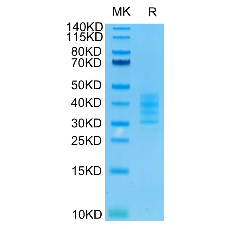 Tris-Bis PAGE - Recombinant Human BCMA Protein (C-terminal His and Avi Tag) (A330150) - Antibodies.com