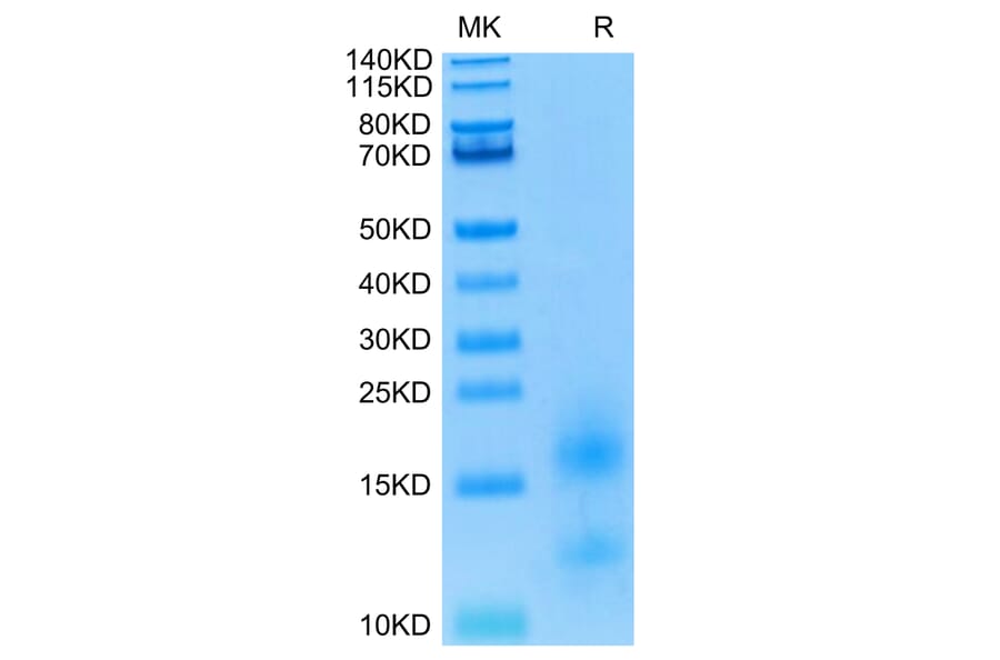 Tris-Bis PAGE - Recombinant Human BCMA Protein (Biotin) (C-terminal His and Avi Tag) (A330151) - Antibodies.com