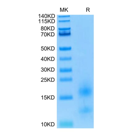Tris-Bis PAGE - Recombinant Human BCMA Protein (Biotin) (C-terminal His and Avi Tag) (A330151) - Antibodies.com