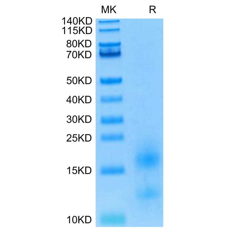 Tris-Bis PAGE - Recombinant Human BCMA Protein (Biotin) (C-terminal His and Avi Tag) (A330151) - Antibodies.com