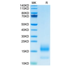 Tris-Bis PAGE - Recombinant Human BCMA Protein (C-terminal His and Avi Tag) (A330152) - Antibodies.com