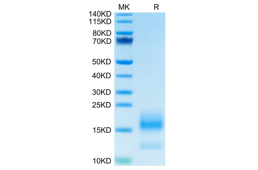 Tris-Bis PAGE - Recombinant Human BCMA Protein (C-terminal His and Avi Tag) (A330152) - Antibodies.com