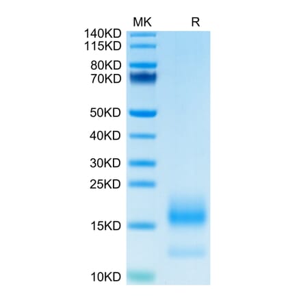 Tris-Bis PAGE - Recombinant Human BCMA Protein (C-terminal His and Avi Tag) (A330152) - Antibodies.com